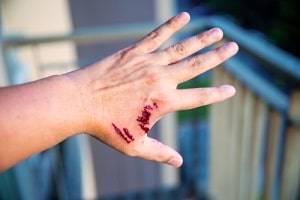 Will County animal attack injury attorney